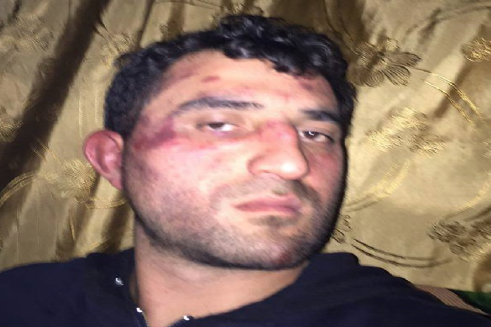 حرس الحدود التركي يعتدي بالضرب على الصحافي السوري ضياء دغمش